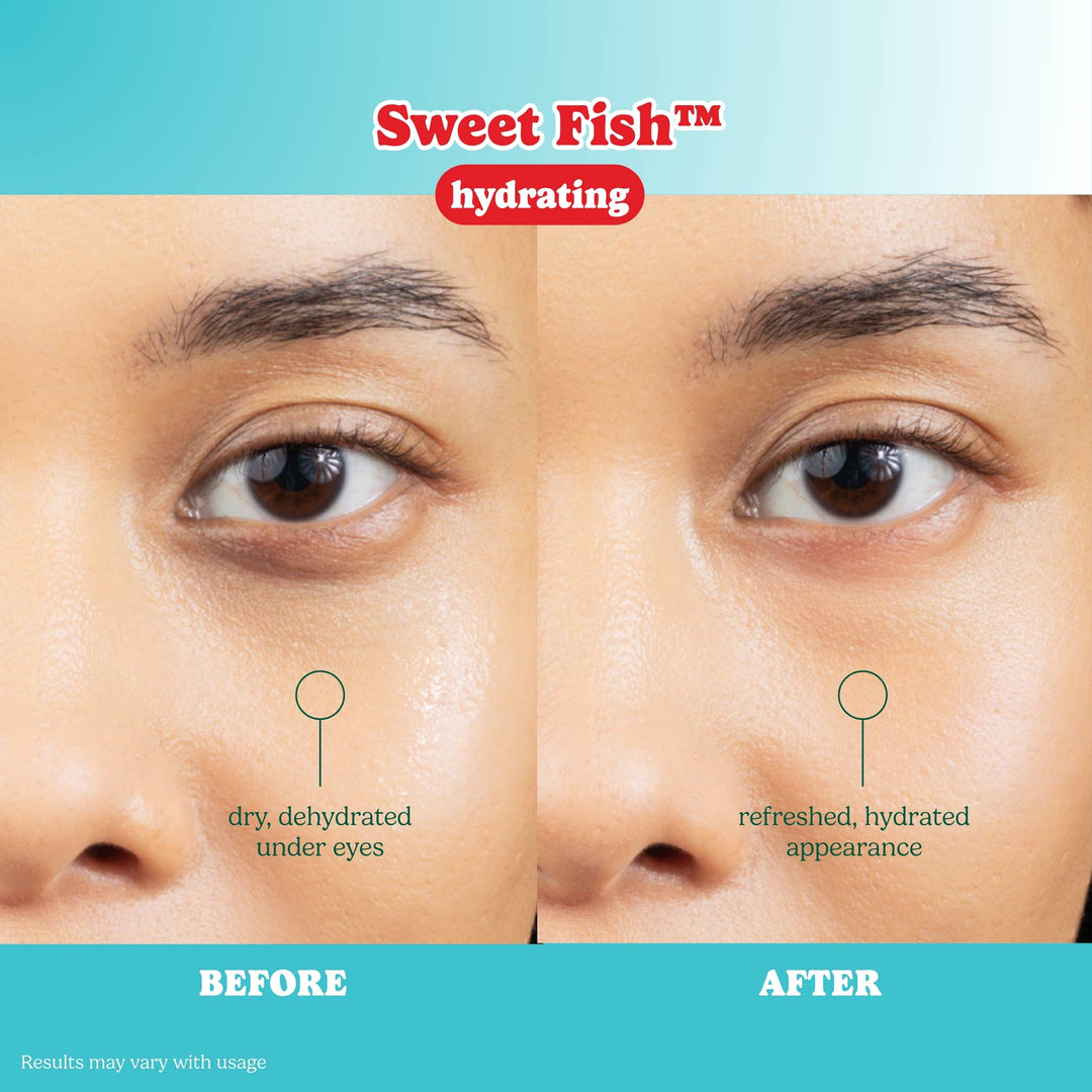 SmartSweets Eye Patches- 3 Types to Choose From